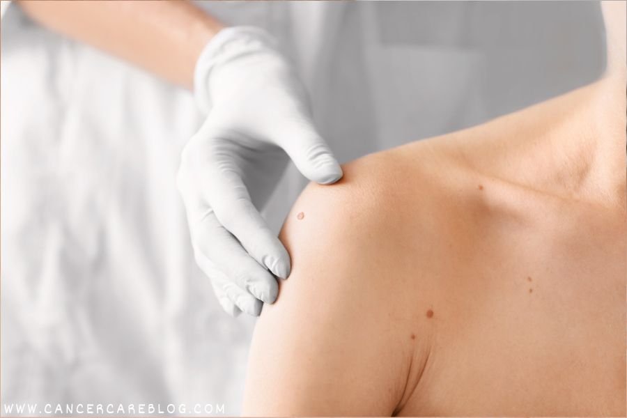 Sarcoma Cancer symptoms