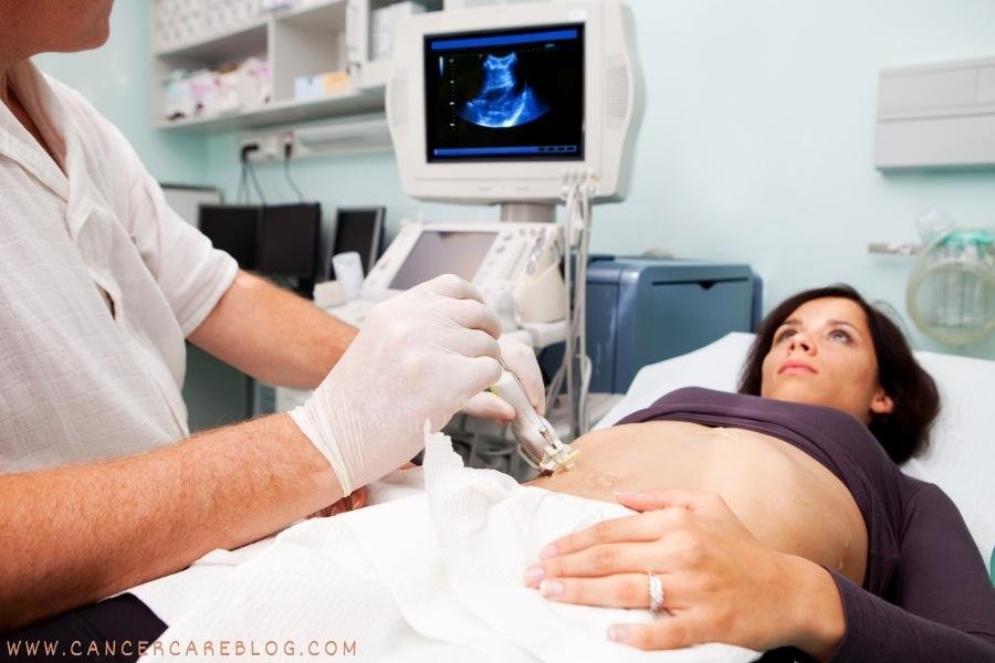 biopsy side effects