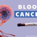 blood cancer diagnosis