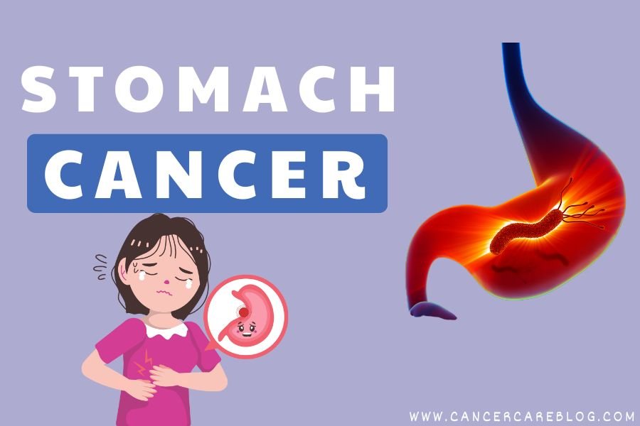 stomach cancer diagnosis