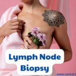 Sentinel Lymph Node Biopsy: Reducing Side Effects in Cancer Surgery