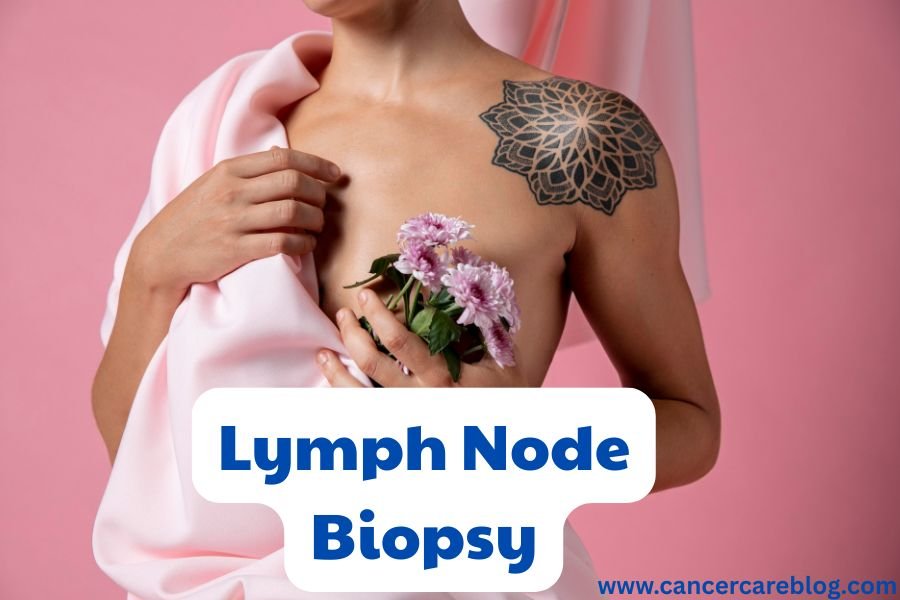 Sentinel Lymph Node Biopsy: Reducing Side Effects in Cancer Surgery